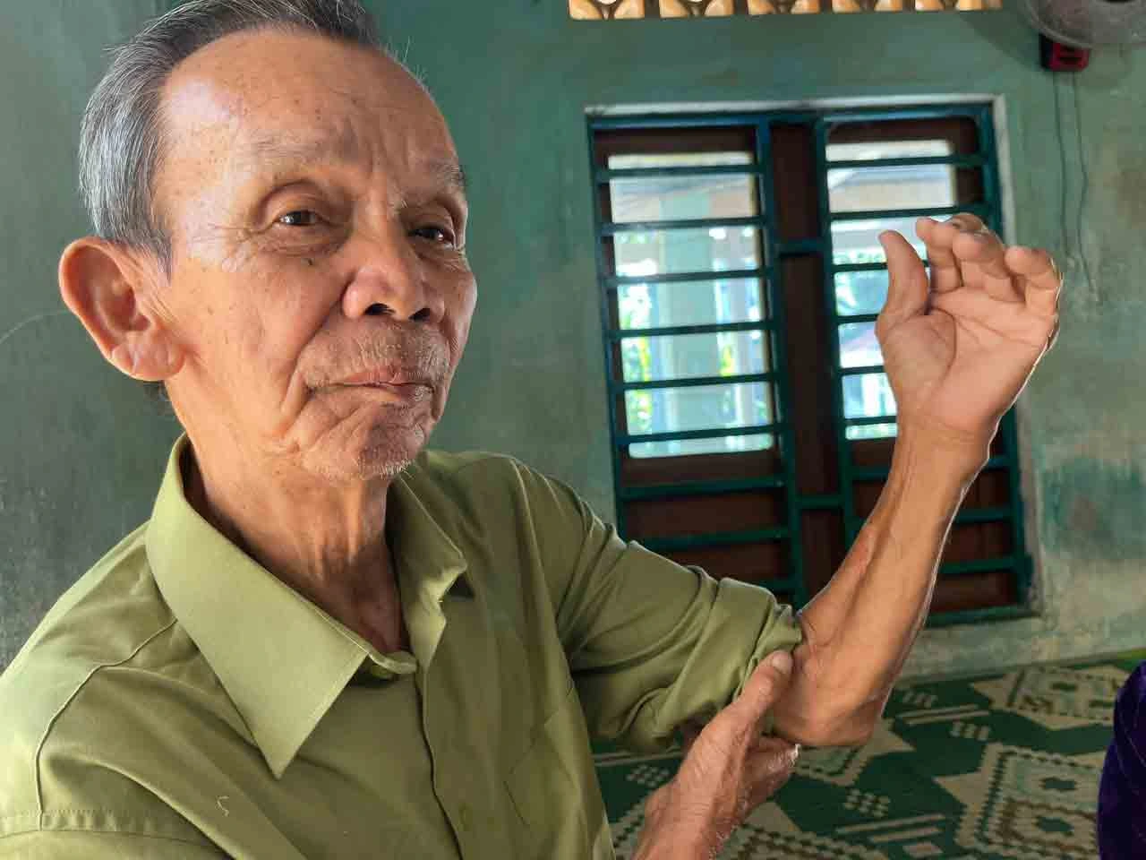 Lê Bỉnh